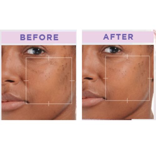 L'Oréal Paris Glycolic Bright Face Daily Foam Cleanser, Infused with Glycolic Acid to Exfoliate and Remove Dullness for Even Glowing Skin - 100ml