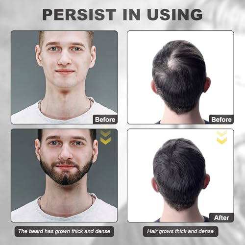 Beard Growth Kit - Beard Kit for Men with Beard Growth Oil (2oz), Beard Balm, Beard Comb, Massager for Spot/Patchy Beard - Christmas, Anniversary, Birthday for Men, Dad, Husband, Boyfriend