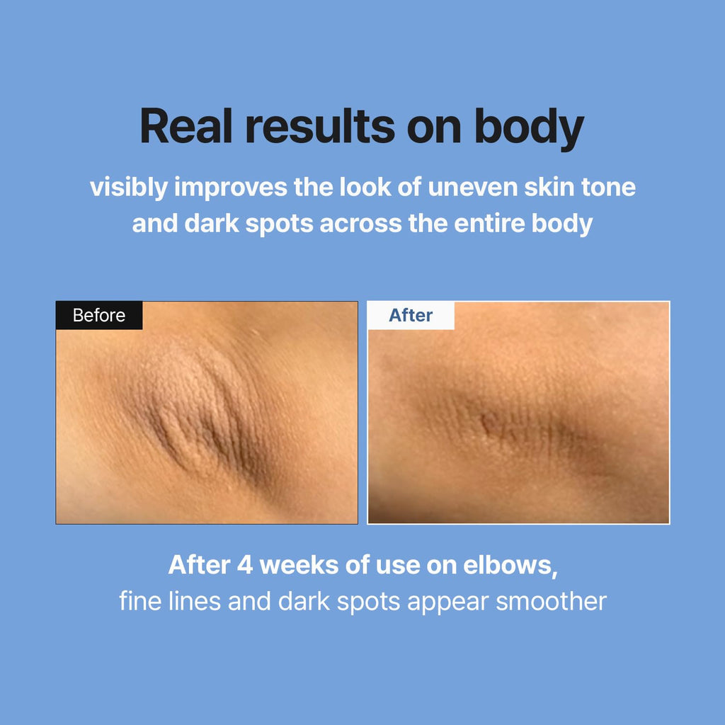 MEDITHERAPY Retinal Skin Booster Serum | Retinaldehyde, Niacinamide Anti-Aging Serum - K-Beauty Facial Serum for Fine Lines, Firming & Radiance | Hydrating Face Serum All Skin Types, 5.07 fl oz