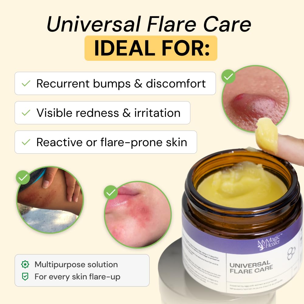 MyMagicHealer Universal Flare Care – Solution for Everyday Skin Flare-Ups | Drawing Salve for Boils & Cysts, Hidradenitis Suppurativa, Folliculitis | Irritated Skin and Chafing Relief 2 oz