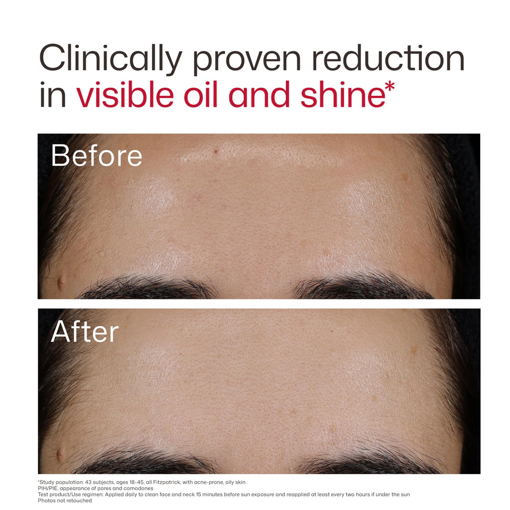 EltaMD UV Clear Blemish-Prone & Oil Balancing SPF 50, Non-Comedogenic Sunscreen with Zinc Oxide, Dermatologist Recommended