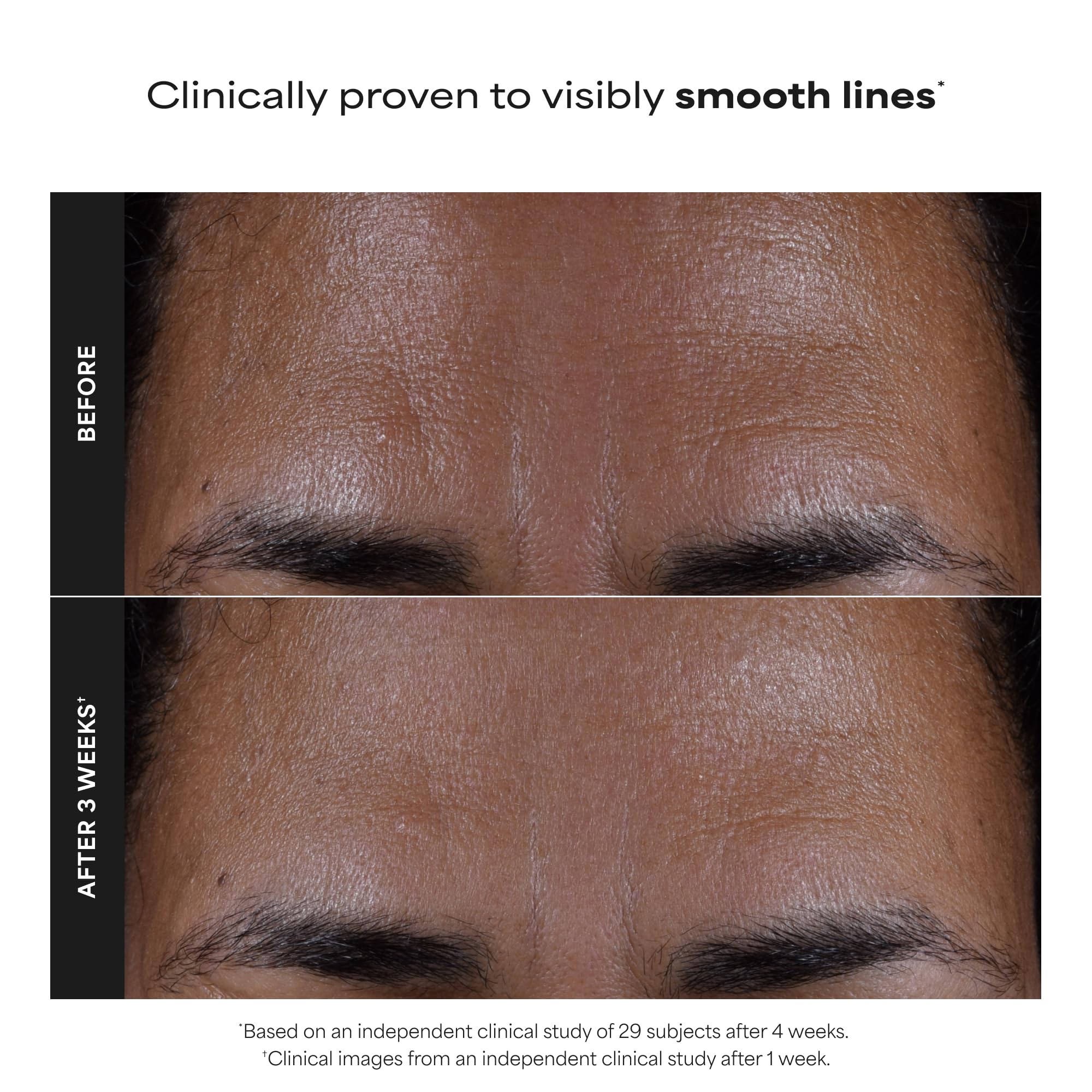 Paula's Choice SKIN PERFECTING 2% BHA Liquid Exfoliant with Salicylic Acid, Facial Polish for Pores, Wrinkles & Fine Lines, Suitable for Blackhead-Prone Skin, Fragrance-Free (5 Fl Oz (Pack of 2))