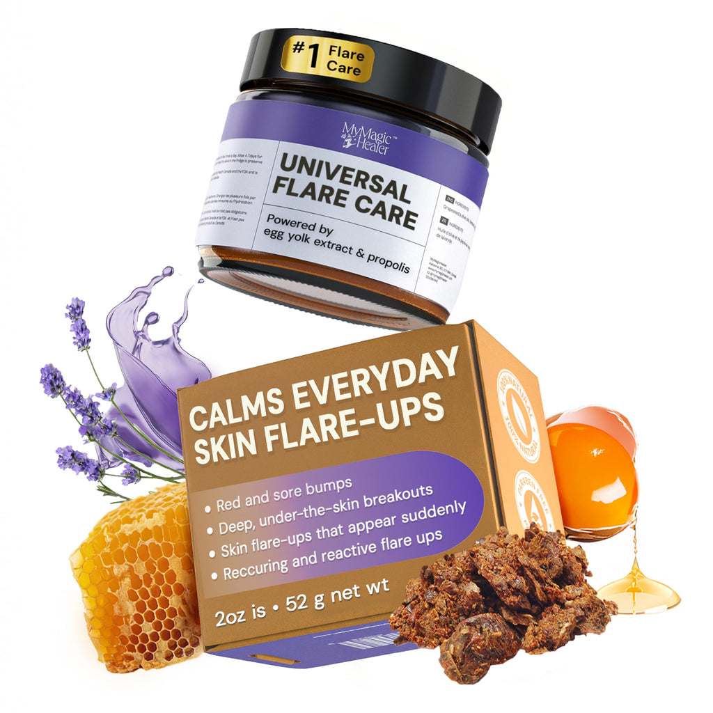 MyMagicHealer Universal Flare Care – Solution for Everyday Skin Flare-Ups | Drawing Salve for Boils & Cysts, Hidradenitis Suppurativa, Folliculitis | Irritated Skin and Chafing Relief 2 oz