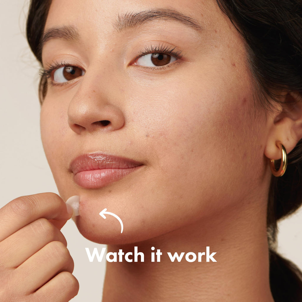 Mighty Patch Original Patch from Hero Cosmetics - #1 Best Selling Hydrocolloid Acne Pimple Patches for Face, Shrinking Zits & Whiteheads in 1 Use, Nighttime Spot Pimple Stickers for Face, 75 Count