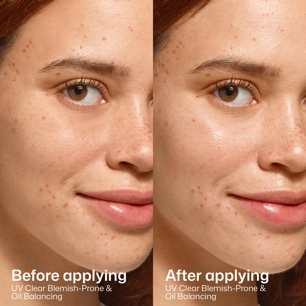 EltaMD UV Clear Blemish-Prone & Oil Balancing SPF 50, Non-Comedogenic Sunscreen with Zinc Oxide, Dermatologist Recommended